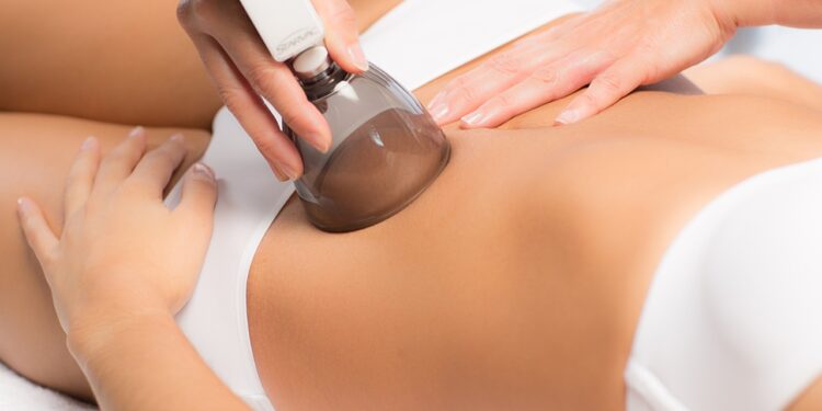 Bańki chińskie na cellulit - X-MAG.pl baner